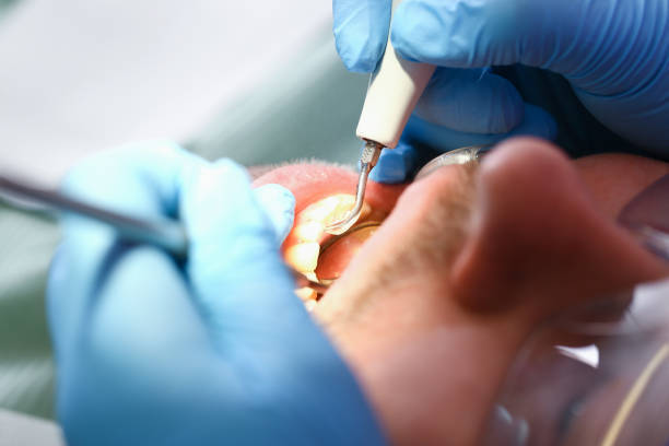 Best After-Hours Emergency Dentist in Nichols Hills, OK